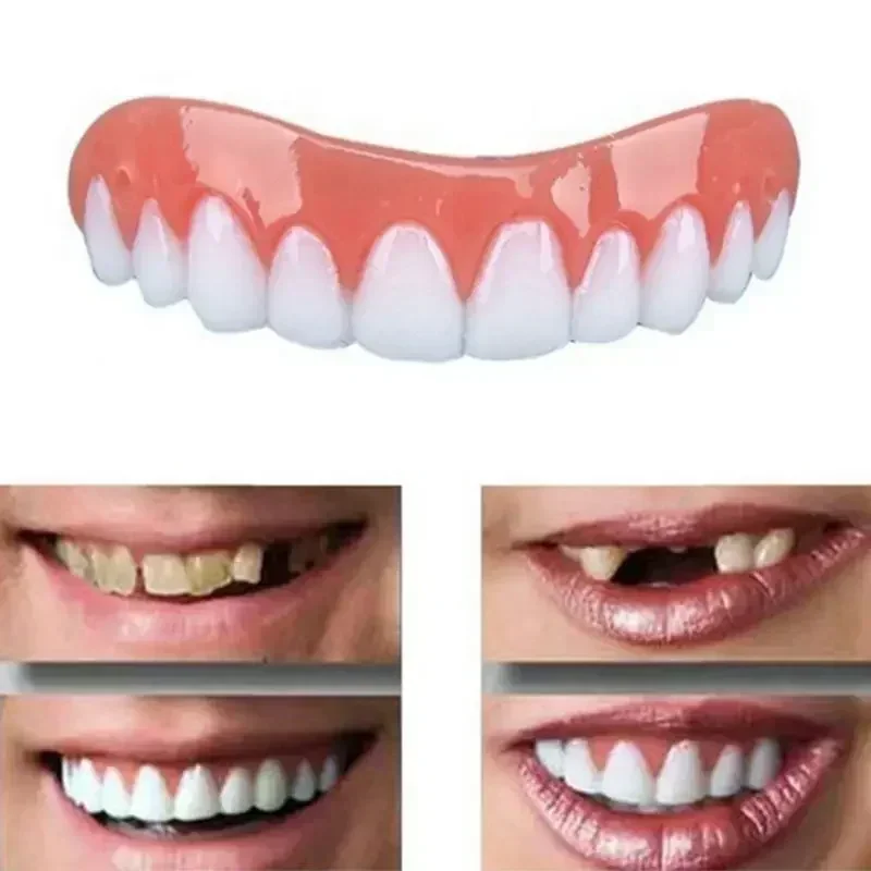 Teeth Whitening With Braces - Nowe sztuczne zęby silikonowe górne i