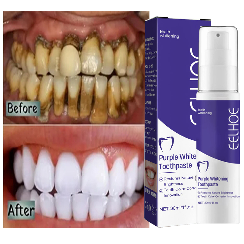 Teeth Whitening Korea - 1 szt. Wybielająca wybielająca pasta do