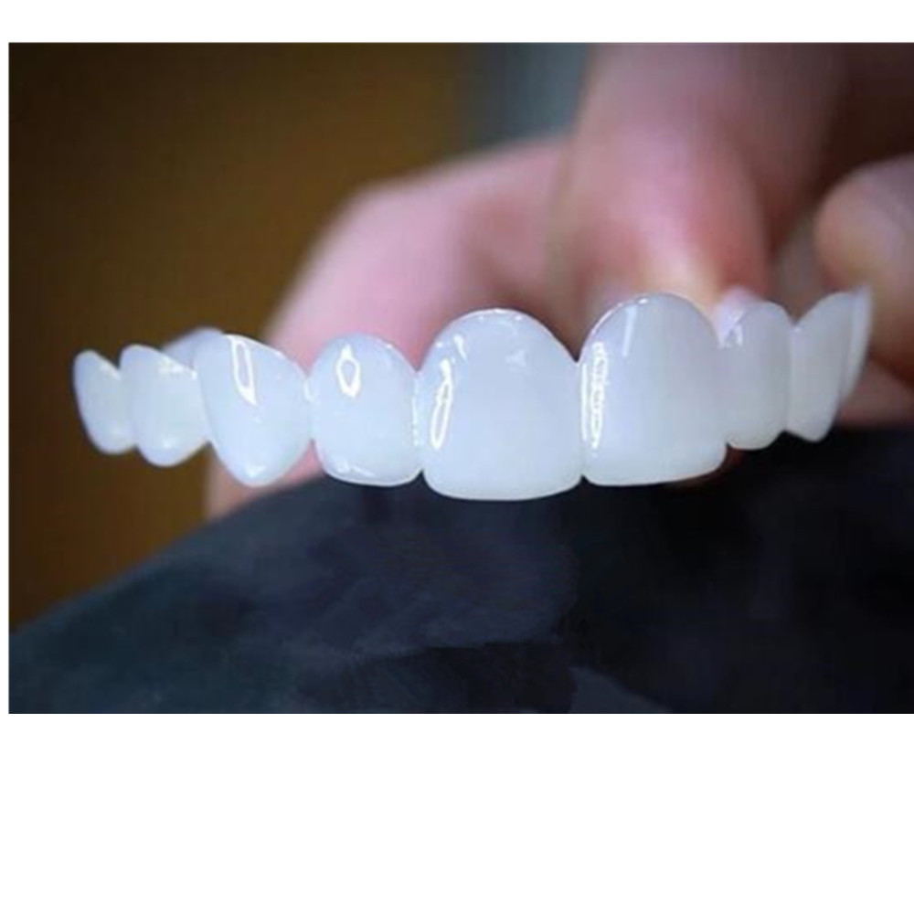 Teeth Whitening With Braces - Wybielające nakładki na zęby, tymczasowe sztuczne