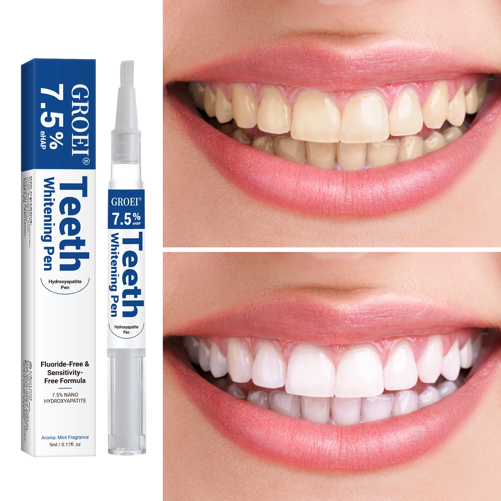 Hydroksiapatytowy długopis do  – Teeth Whitening Clinic recenzja i cena