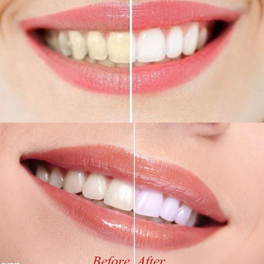 Bambusowy węgiel drzewny zęby  – Teeth Whitening Yellow Teeth recenzja i cena
