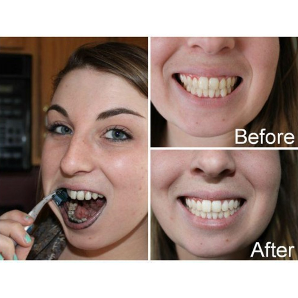 Bambusowy węgiel drzewny zęby  – Teeth Whitening Yellow Teeth recenzja i cena