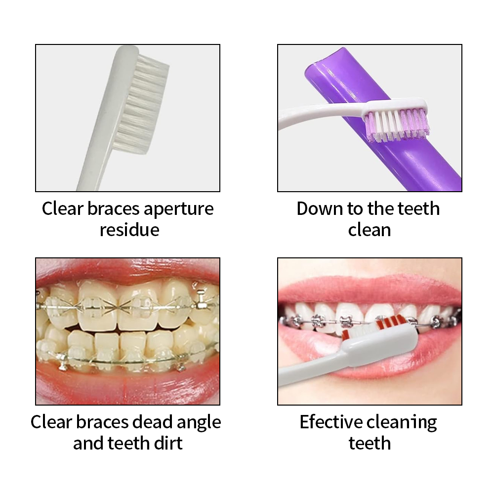 8 sztuk/zestaw zestaw szczotec – Teeth Whitening With Braces recenzja i cena