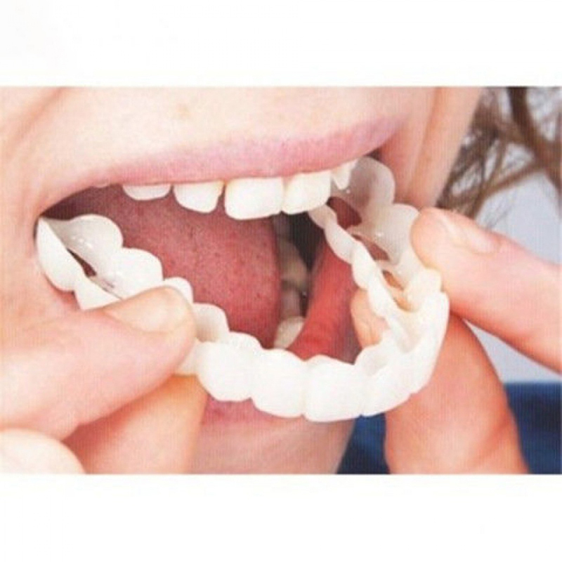 Idealnie Dopasowane Nakładki n – Teeth Whitening With Braces recenzja i cena