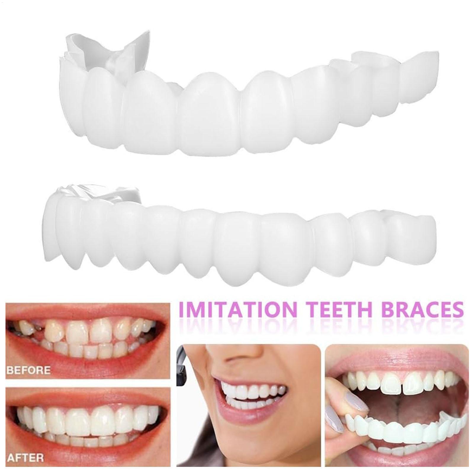 Sztuczne zęby górne i dolne, n – Teeth Whitening With Braces recenzja i cena