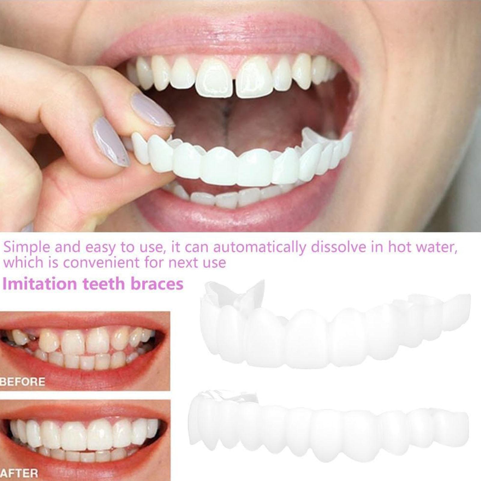 Sztuczne zęby górne i dolne, n – Teeth Whitening With Braces recenzja i cena
