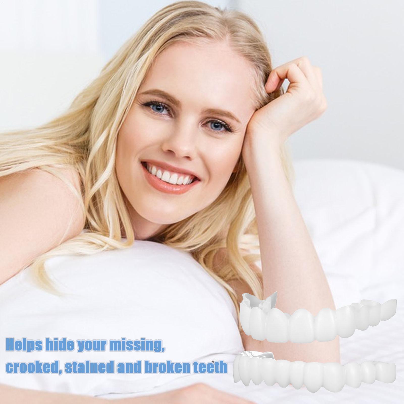 Sztuczne zęby górne i dolne, n – Teeth Whitening With Braces recenzja i cena
