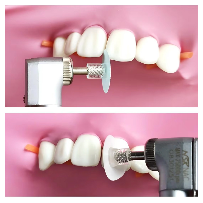 40 szt. Dyski polerskie dentys – Teeth Whitening Express recenzja i cena