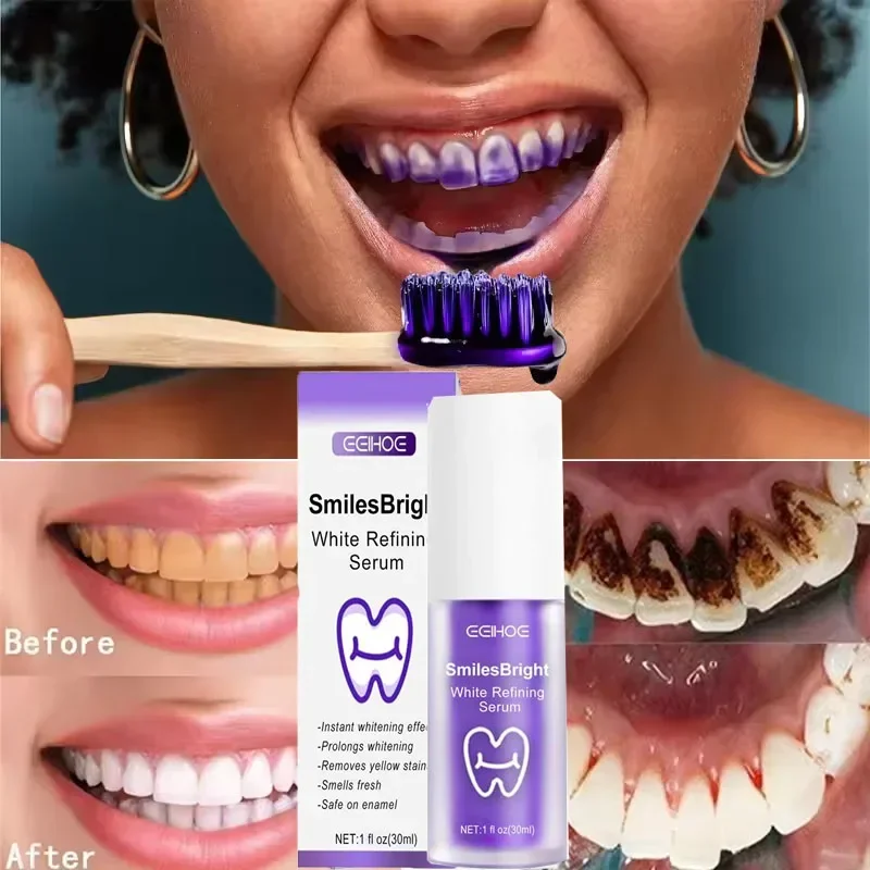 Pasta do czyszczenia i wybiela – Teeth Whitening Korea recenzja i cena