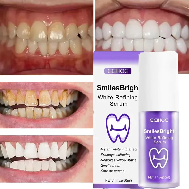 Pasta do czyszczenia i wybiela – Teeth Whitening Korea recenzja i cena