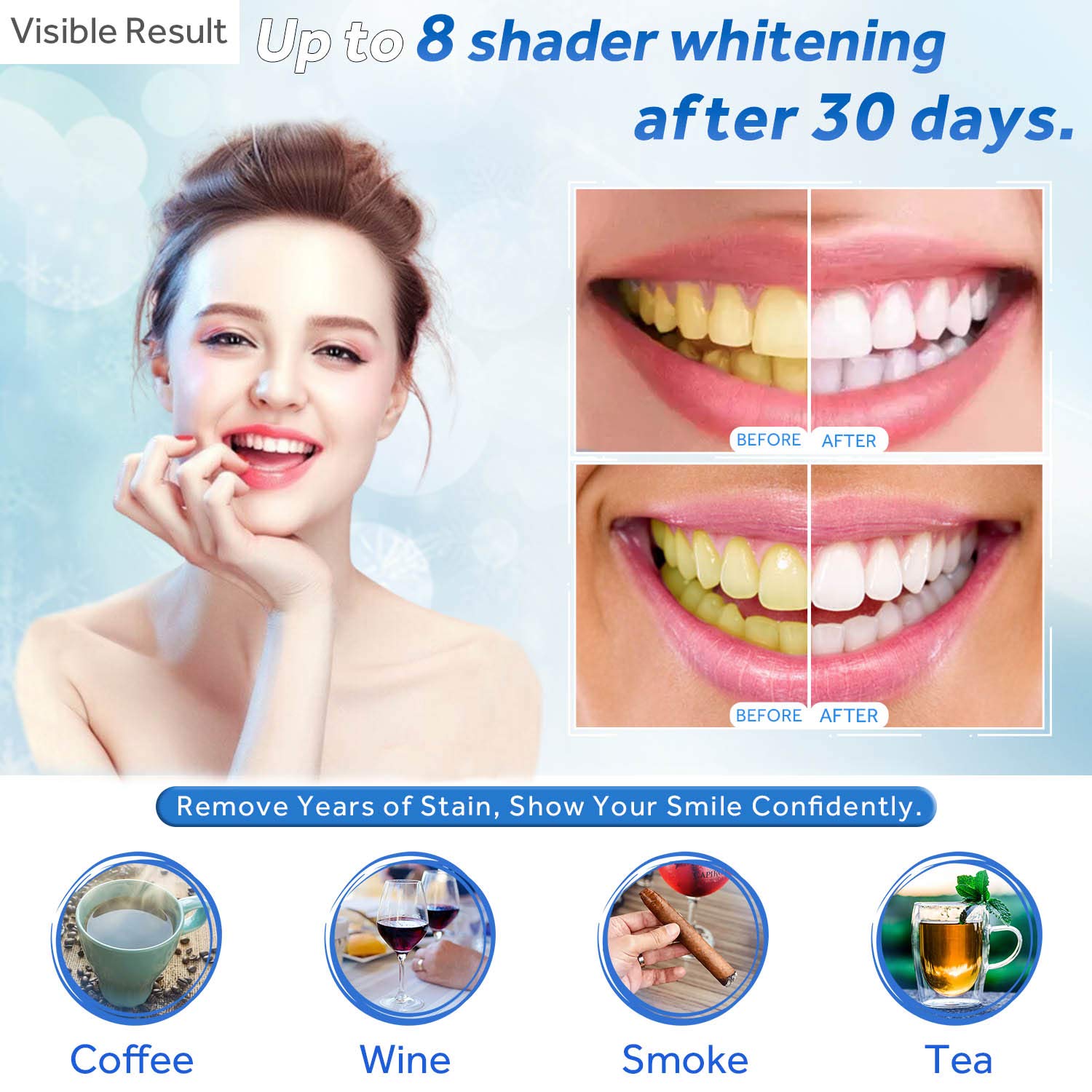 Żel do wybielania zębów w strz – Teeth Whitening Clinic recenzja i cena