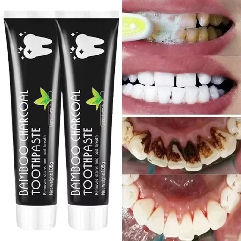 Pasta do zębów wybielająca Pas – Teeth Whitening Yellow Teeth recenzja i cena