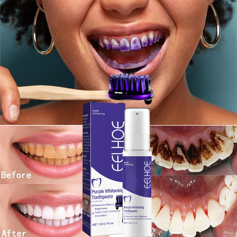 1 szt. Wybielająca wybielająca – Teeth Whitening Korea recenzja i cena