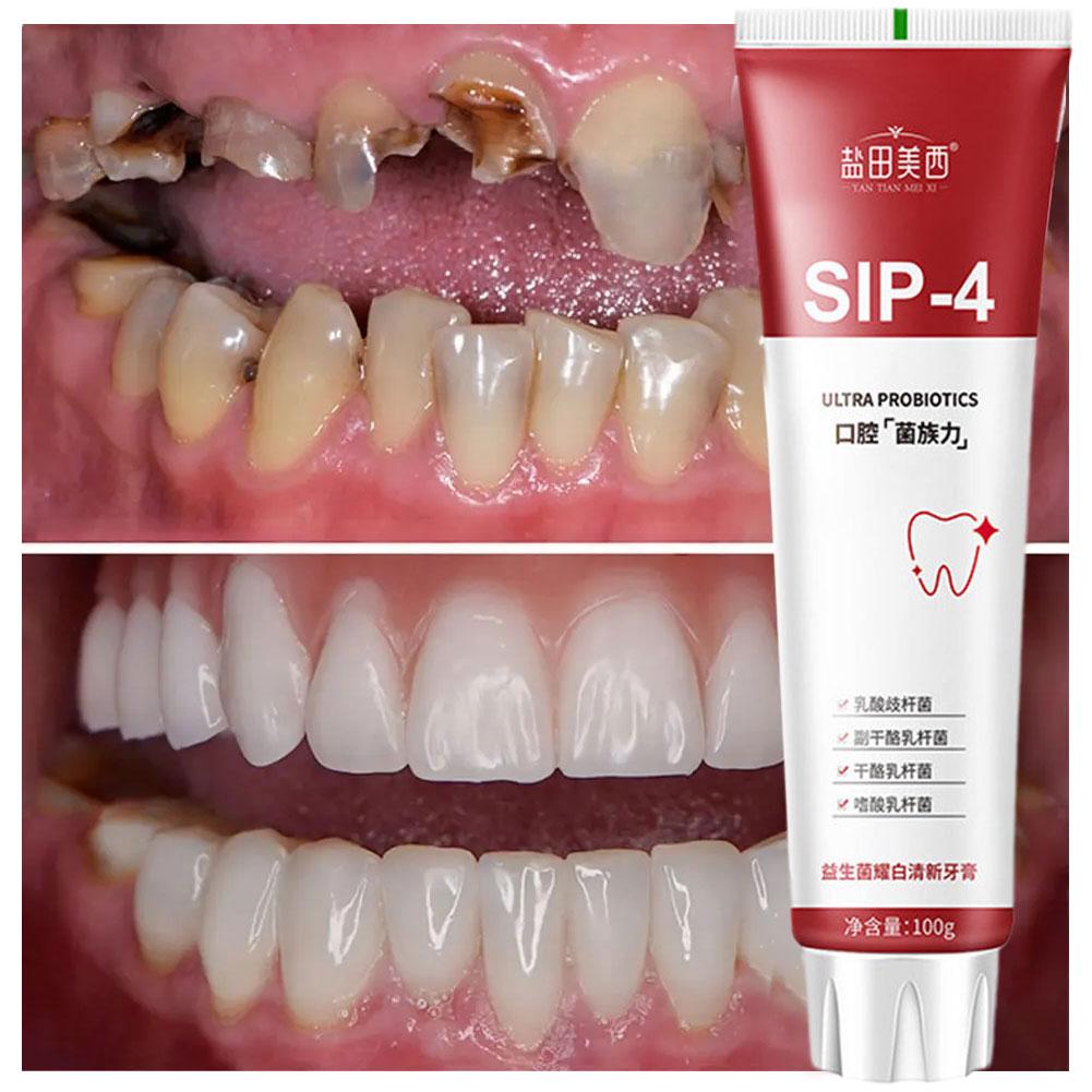 100g Sip-4 Probiotyczna Pasta  – Teeth Whitening Yellow Teeth recenzja i cena