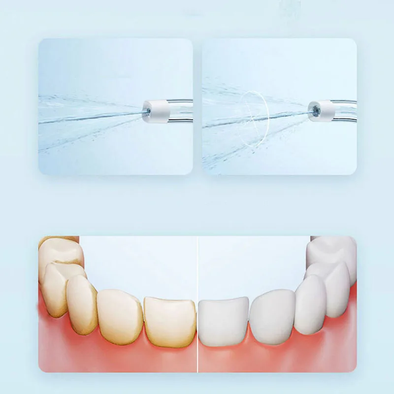 Xiaomi Przenośny Irrygator Ora – Teeth Whitening Or Tooth Whitening recenzja i cena