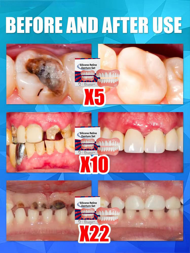 Sztuczne zęby silikonowe górne – Teeth Whitening With Braces recenzja i cena