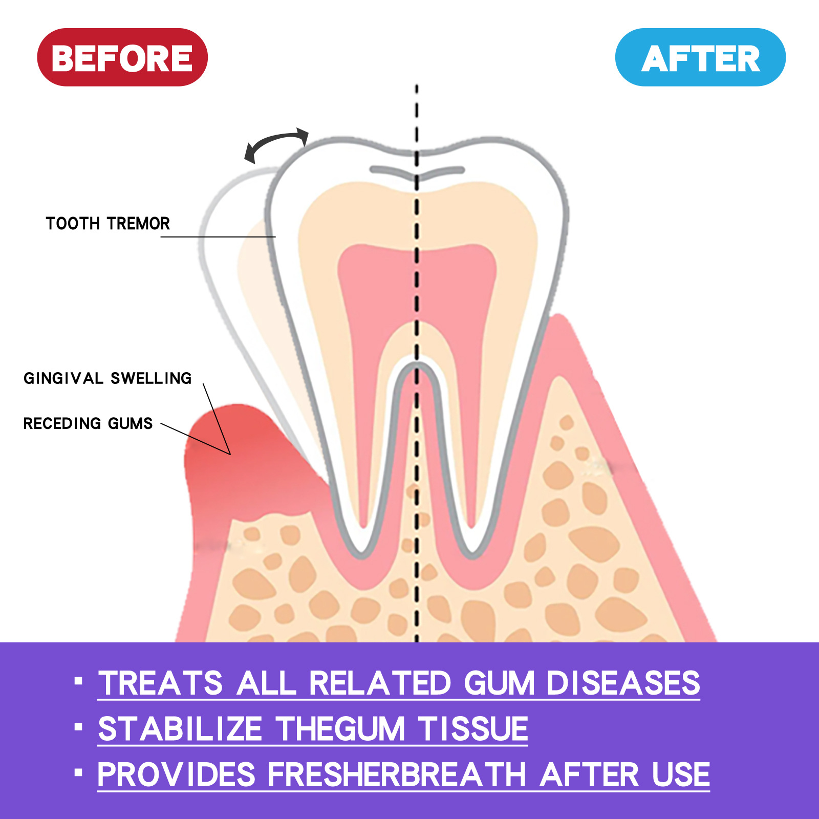 Mus wybielający do zębów 60ml  – Teeth Whitening Yellow Teeth recenzja i cena