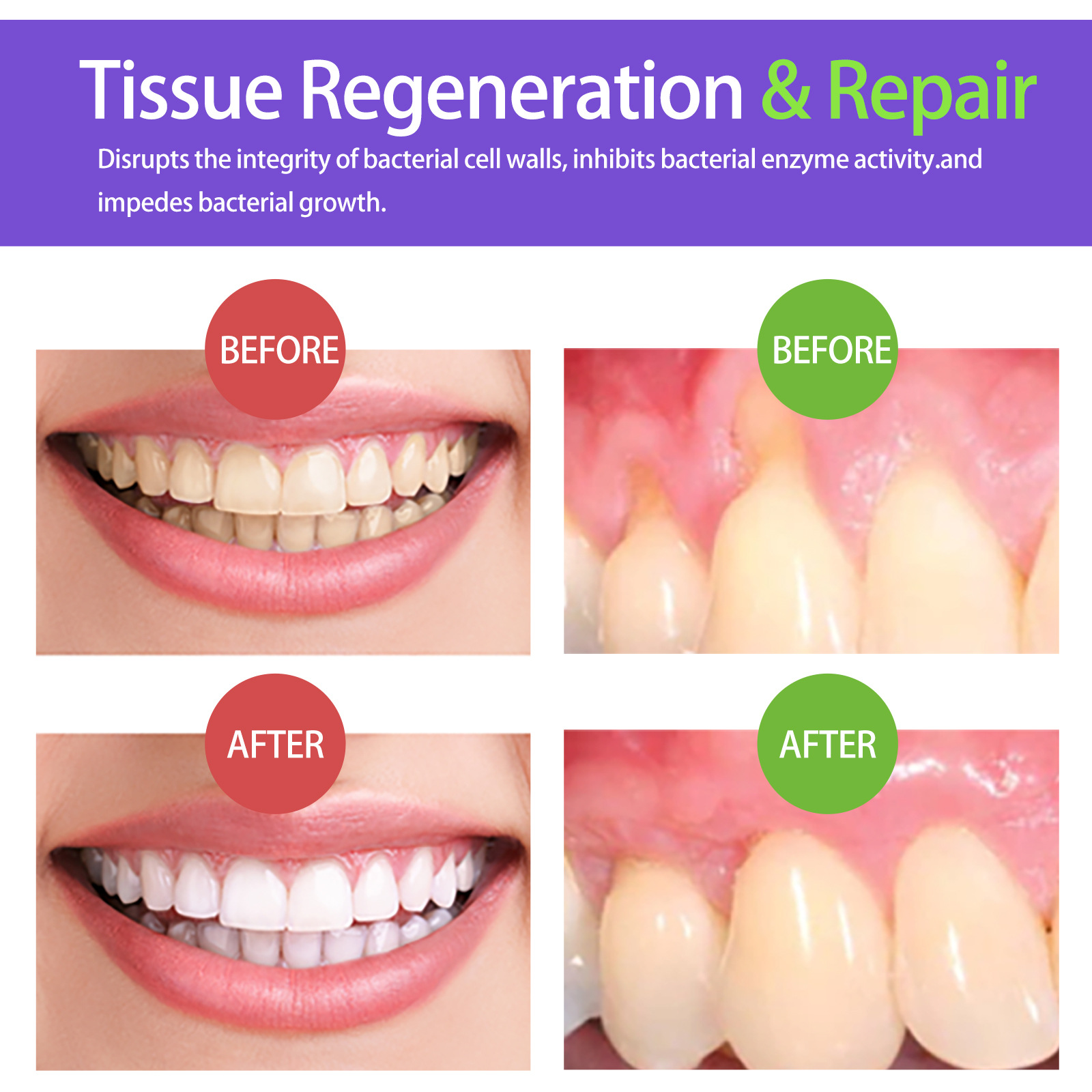 Mus wybielający do zębów 60ml  – Teeth Whitening Yellow Teeth recenzja i cena
