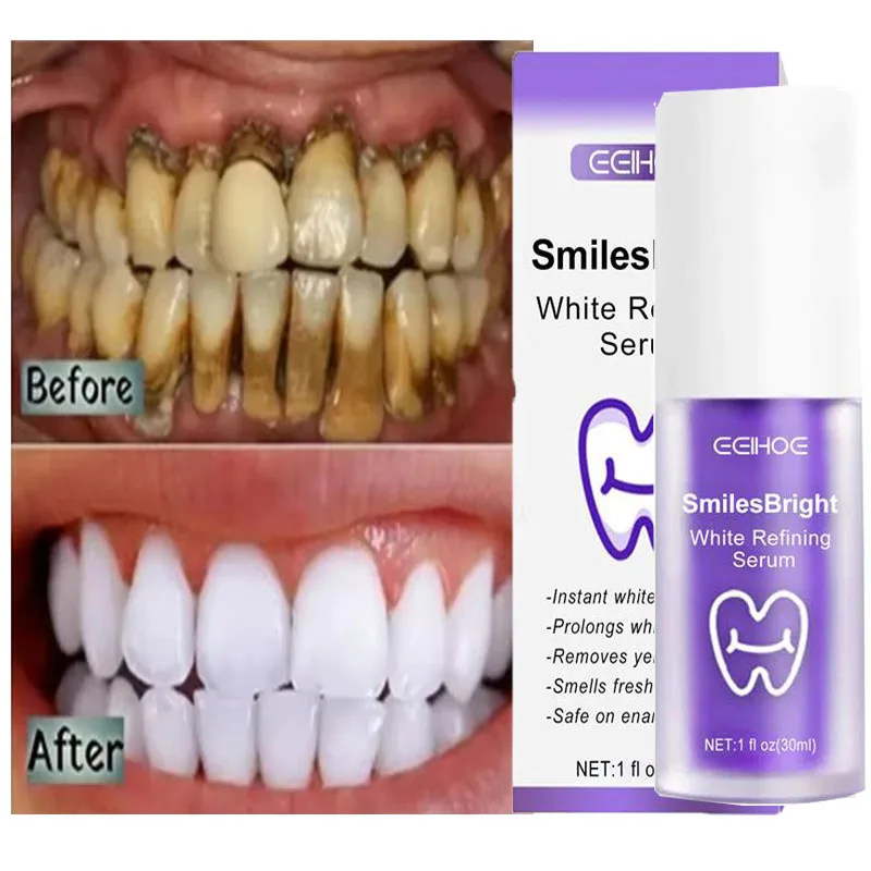 Oczyszczanie zębów Wybielająca – Teeth Whitening Korea recenzja i cena