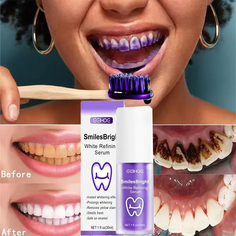 Oczyszczanie zębów Wybielająca – Teeth Whitening Korea recenzja i cena