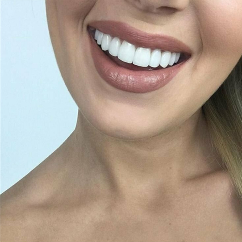 Wybielające nakładki na zęby,  – Teeth Whitening With Braces recenzja i cena