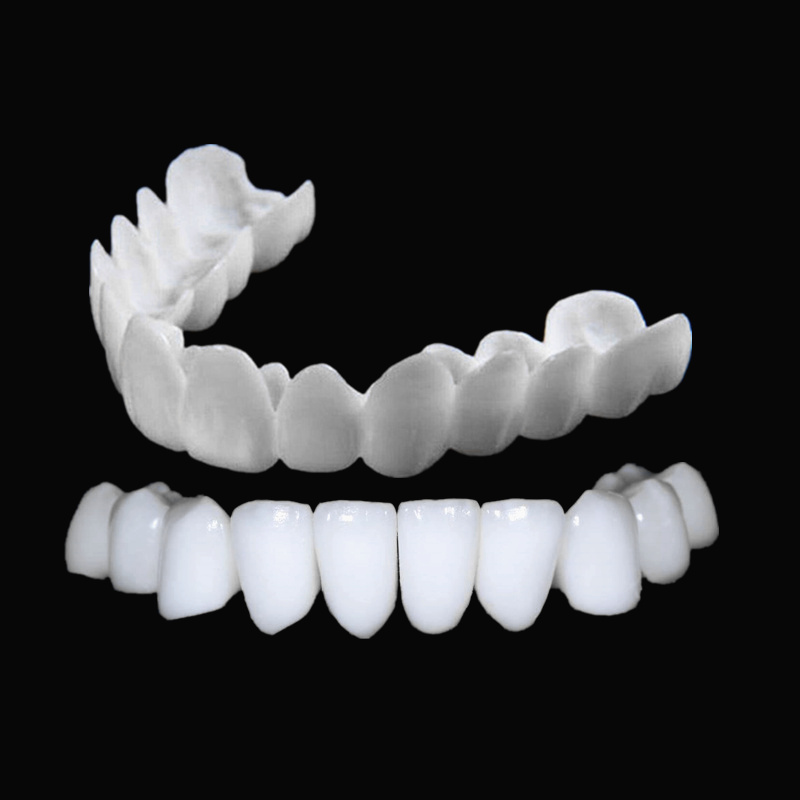 Nakładki na zęby Smile Dental, – Teeth Whitening With Braces recenzja i cena
