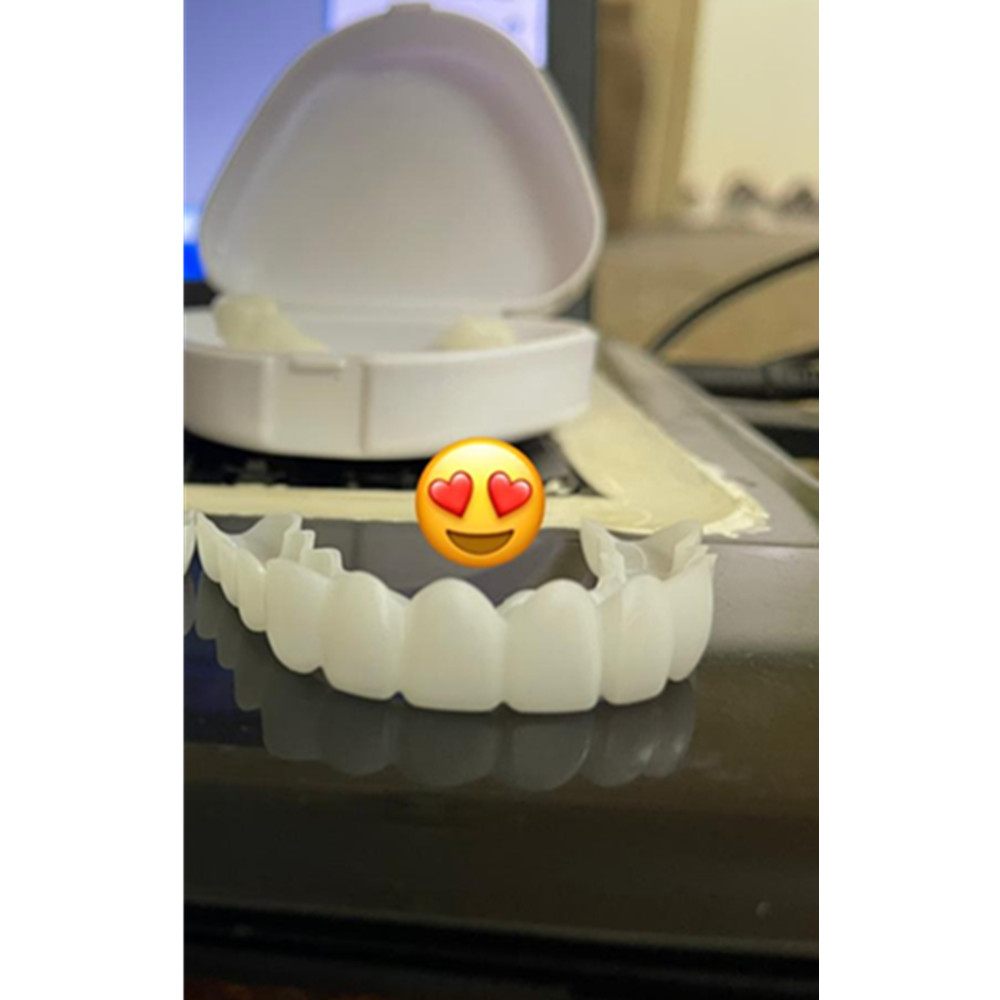 Nakładki na zęby Smile Dental, – Teeth Whitening With Braces recenzja i cena