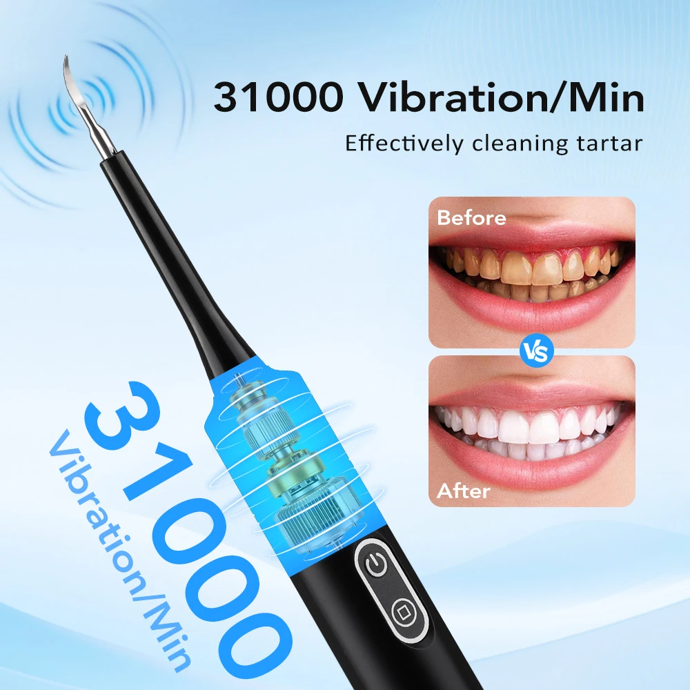 Elektryczny soniczny skaler de – Teeth Whitening Express recenzja i cena
