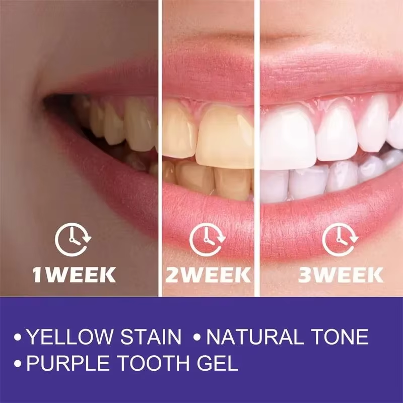 Pasta do czyszczenia i wybiela – Teeth Whitening Korea recenzja i cena